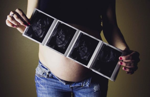 αλλαγές στο σώμα της γυναίκας κατά την εγκυμοσύνη διαιτολόγος Θεσσαλονίκη